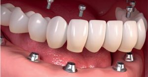 کلینیک دندانپزشکی کیانیان