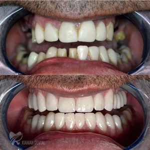 کلینیک دندانپزشکی کیانیان