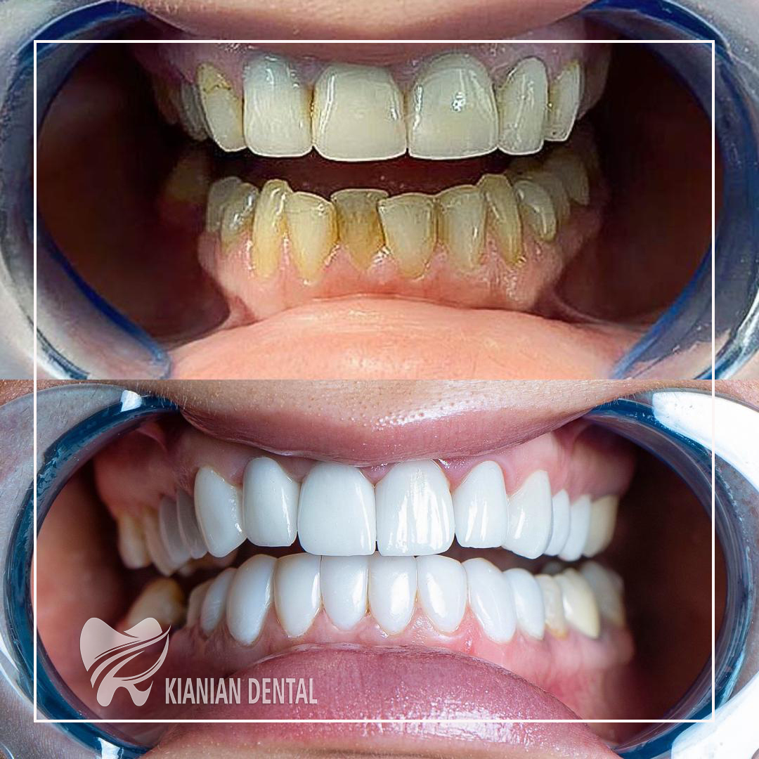 دندانپزشکی دکتر کیانیان